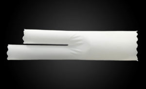 This woven bifurcate is a 3-D device that can be crimped and placed into a catheter and threaded through the femoral artery to the aorta, where it is deployed. Photo: Bally Ribbon Mills