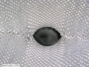 ATEX Technologies’ implantable textiles can be formulated into a dimensionally shaped tubular weave that allows the inner diameter to transition in size to align with a patient’s anatomy. This image shows a magnification of 100. Photo: ATEX Technologies Inc.